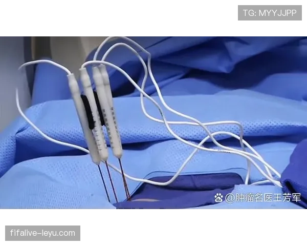 托比亚斯近期伤病情况及恢复进展分析